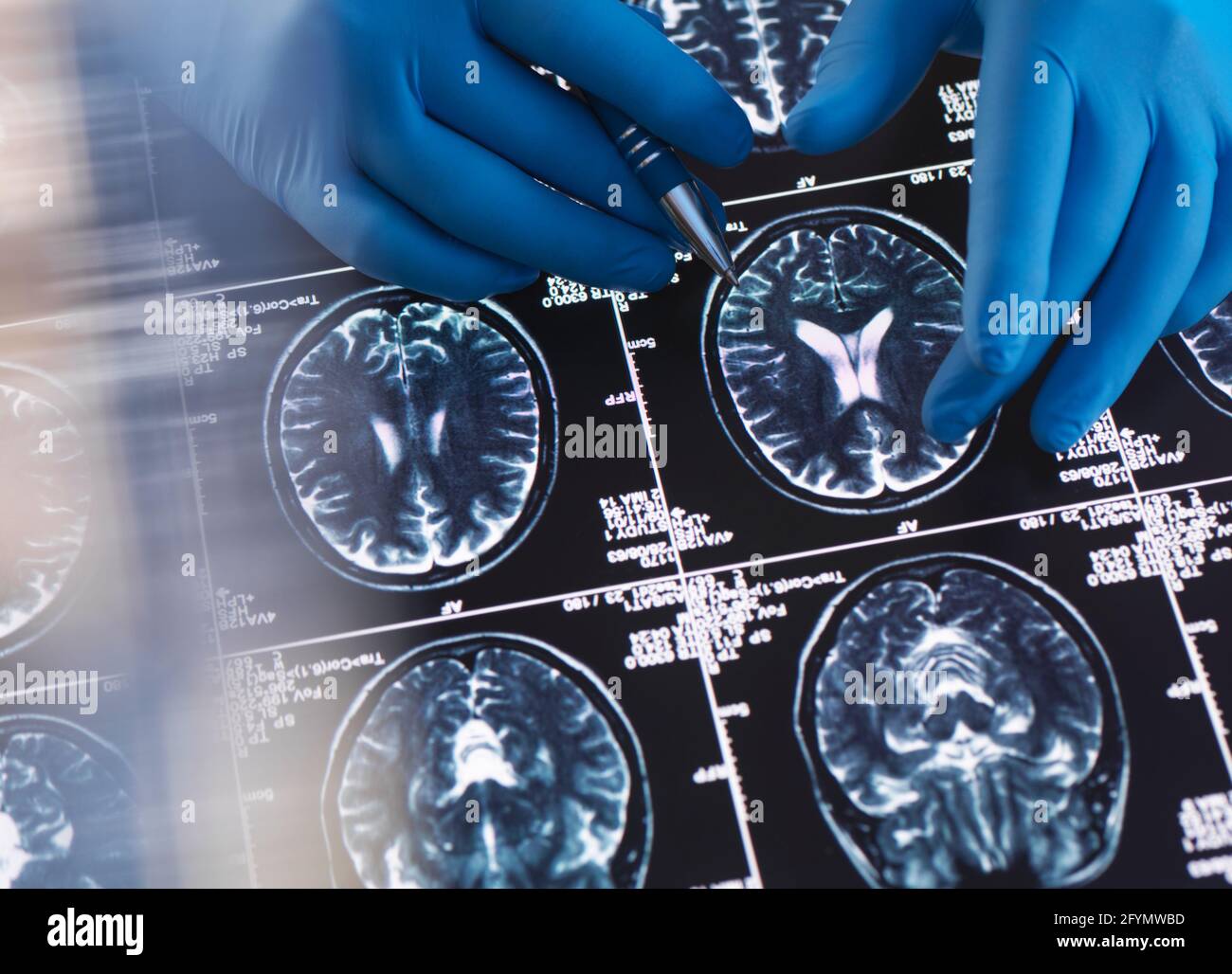 Neurologische Diagnose Stockfoto