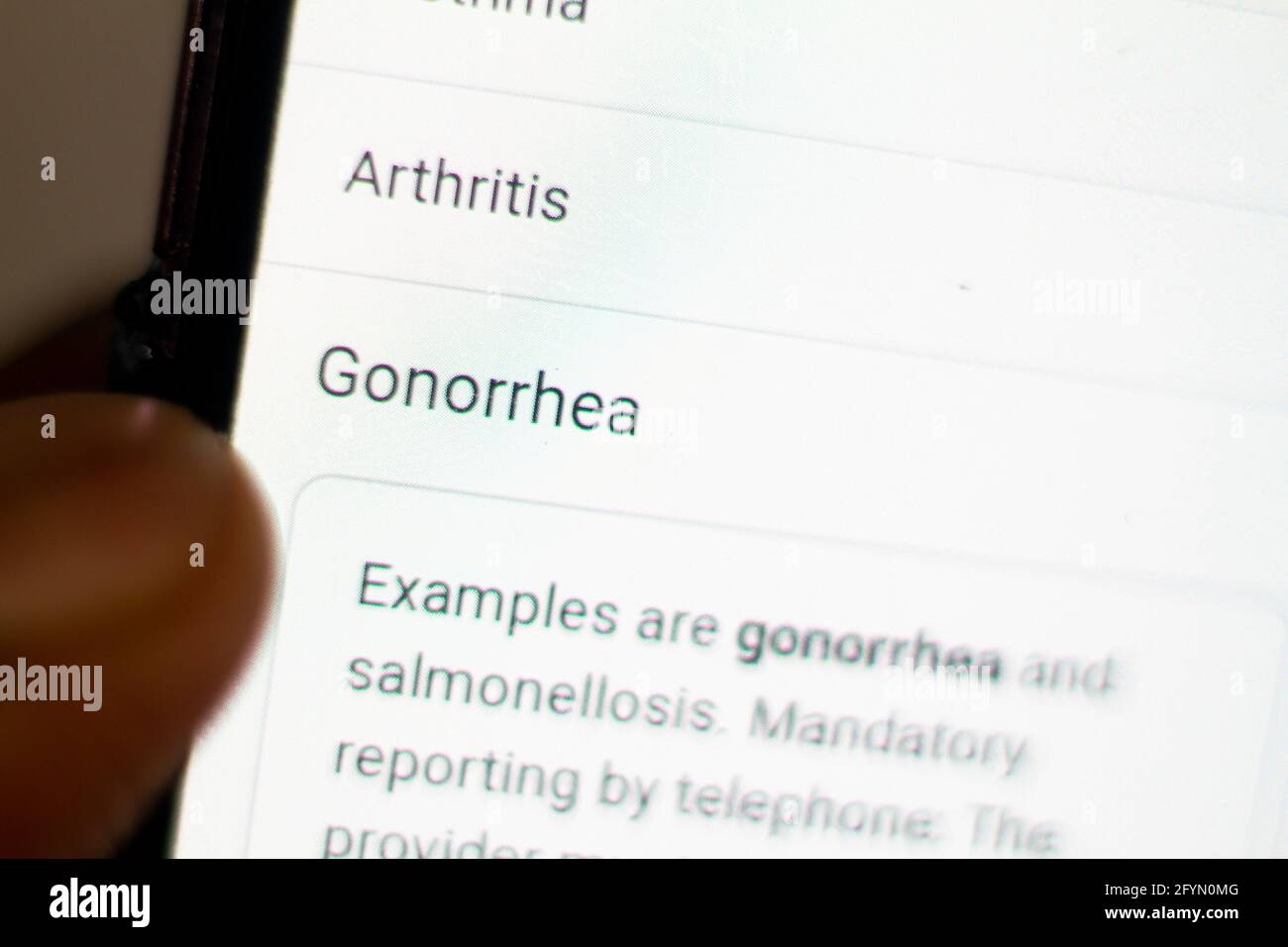 Gonorrhoe News.Nachrichten auf dem Handy.Handy in den Händen. Selektiver Fokus und chromatische Aberration Effekte. Stockfoto