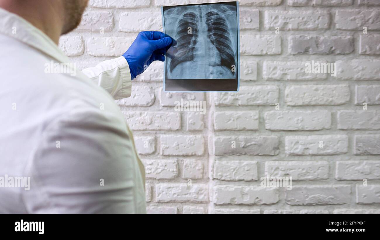 Röntgenaufnahme der menschlichen Lunge. Der Arzt diagnostiziert den Patienten. Röntgen des Thorax. Stockfoto