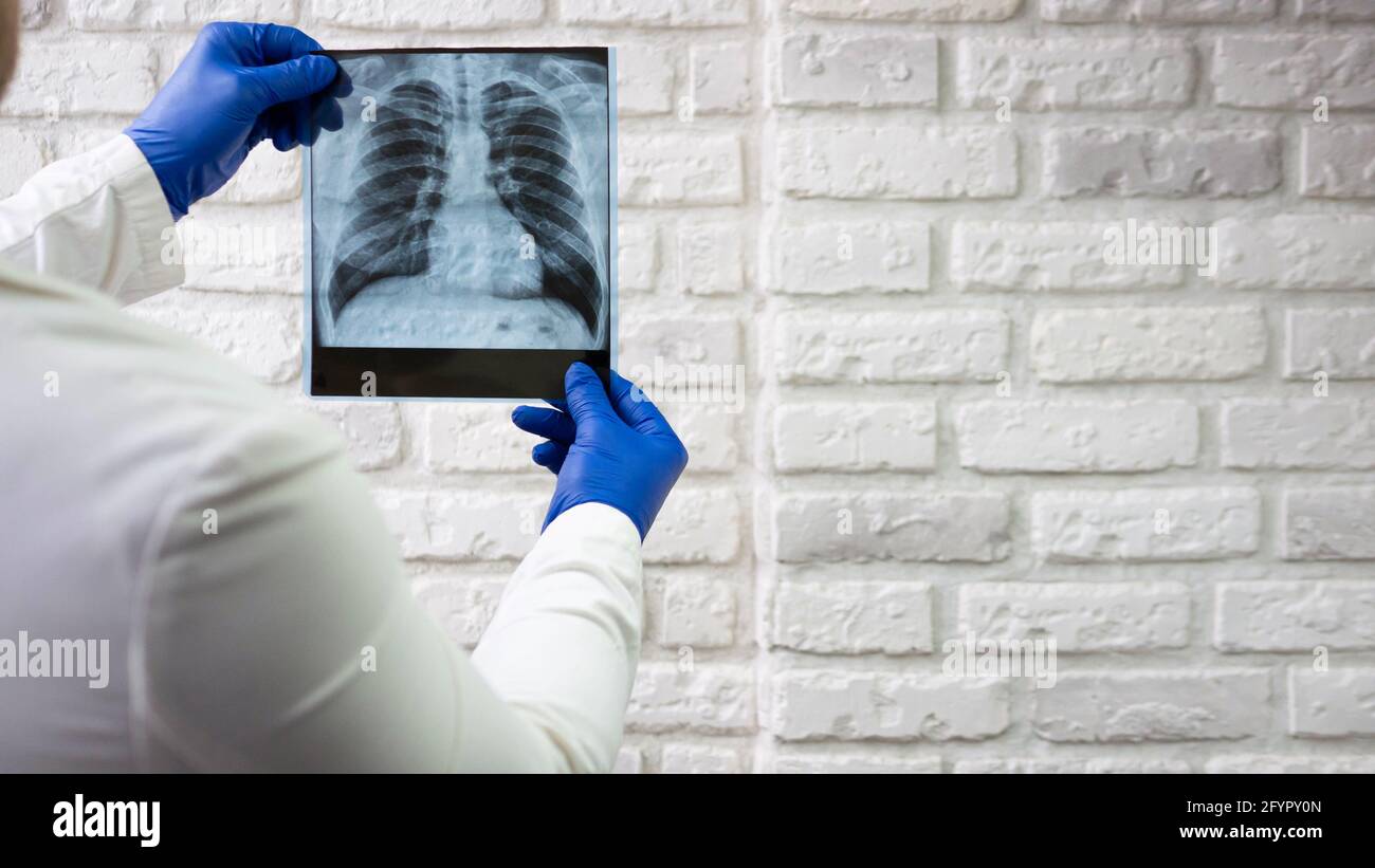 Röntgenaufnahme der menschlichen Lunge. Der Arzt diagnostiziert den Patienten. Röntgen des Thorax. Stockfoto