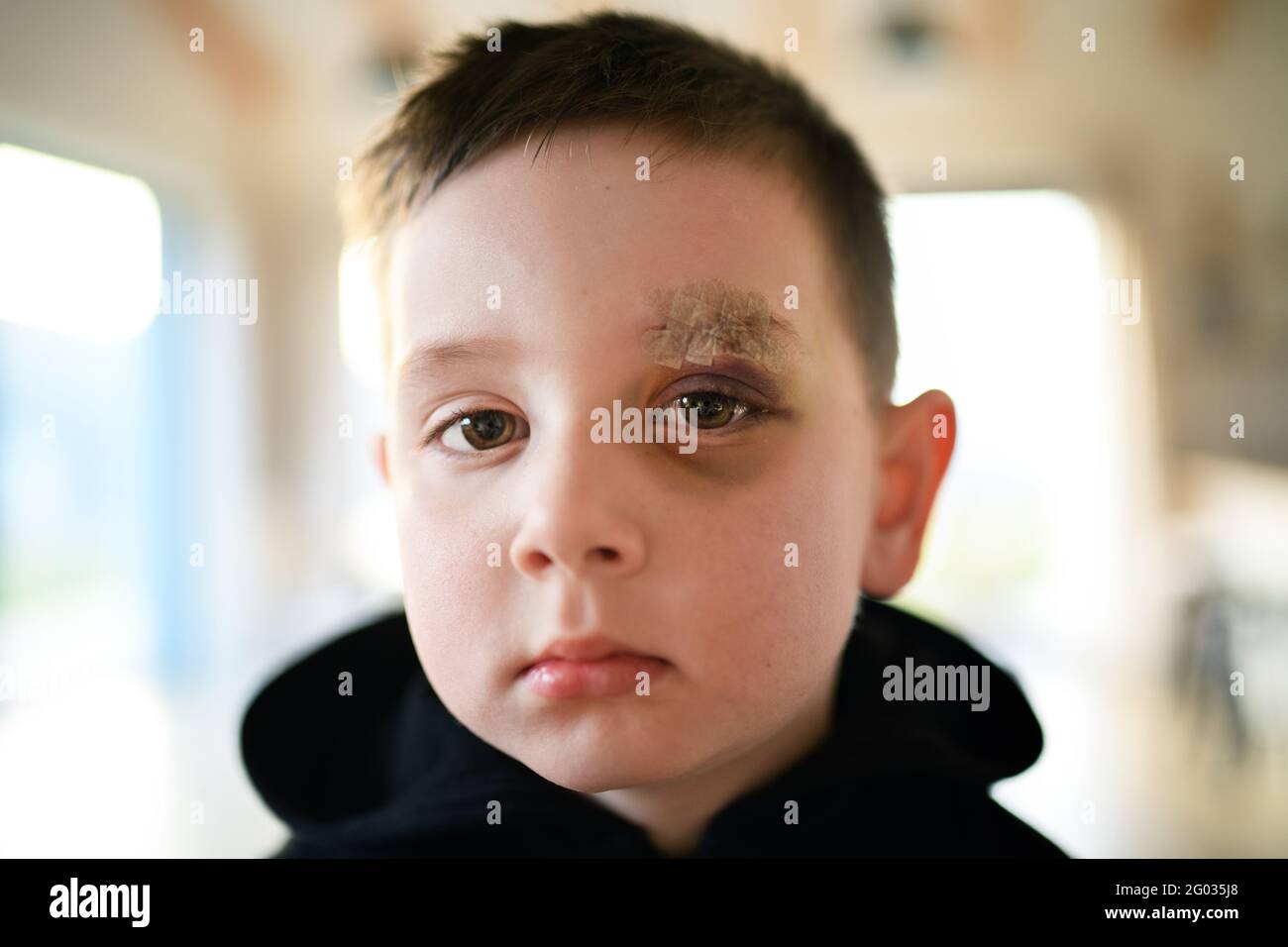 Armer trauriger kleiner Junge mit geschnittener Augenbraue, der zuhause drinnen steht, Armutskonzept. Stockfoto