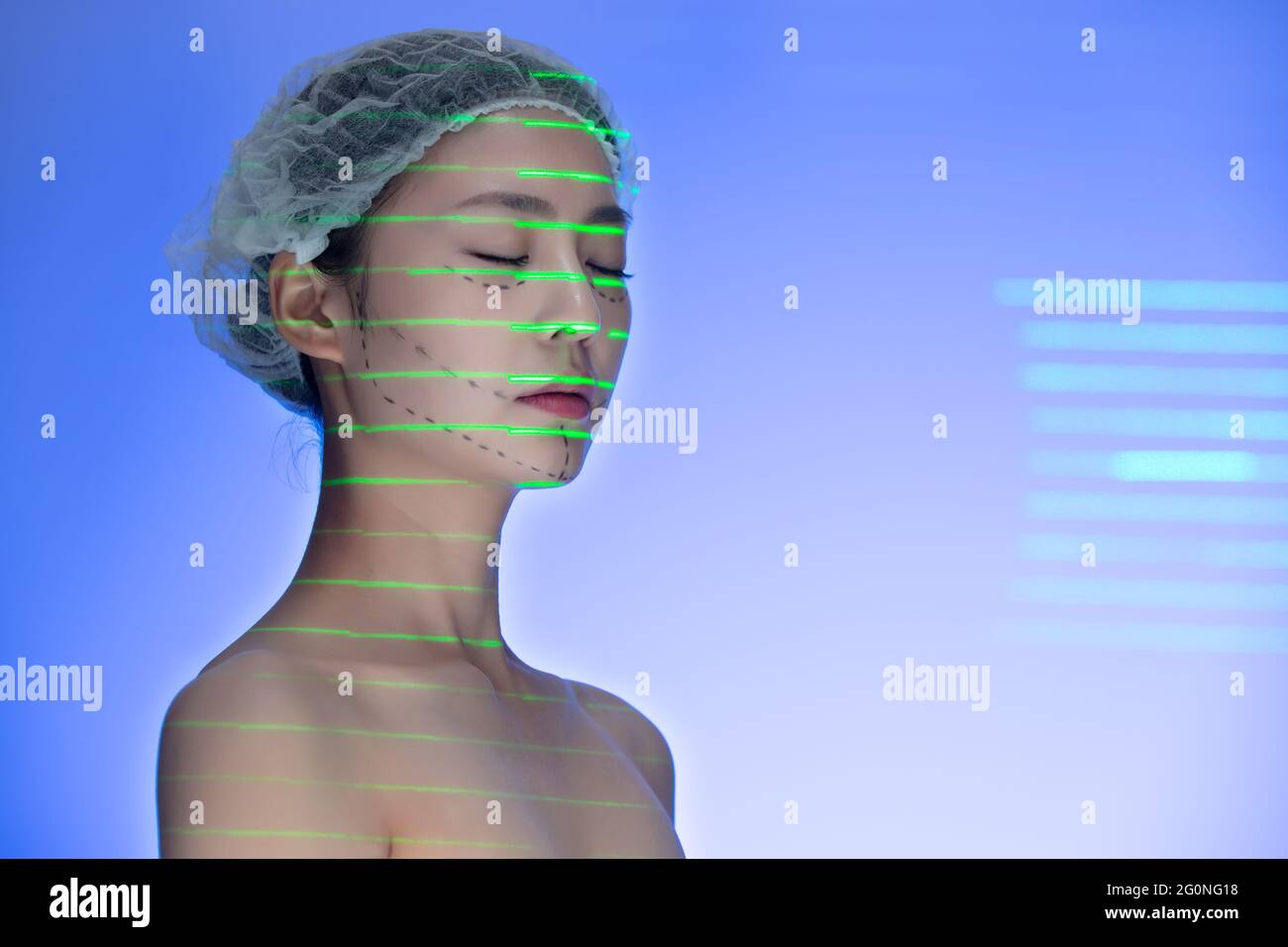 Junge Frau tun Laser-Kosmetik Stockfoto