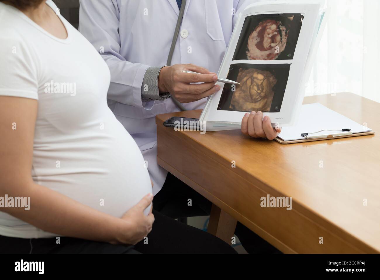 Arzt hält das 4D-Ultraschallbild und spricht mit der Schwangeren. Während der Schwangerschaft Konzept Stockfoto
