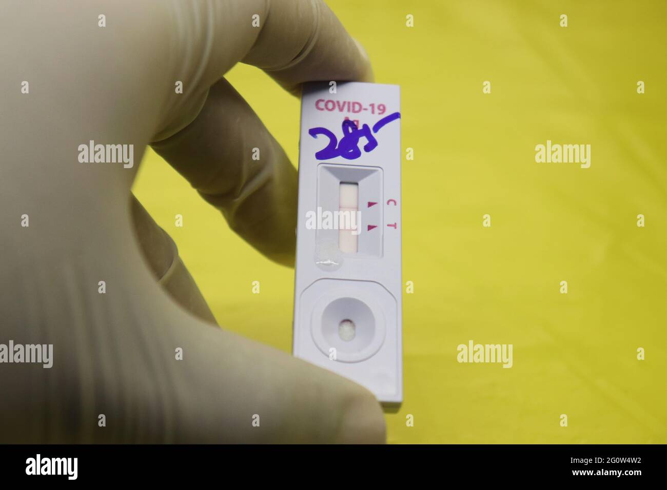 Schnelldiagnosetests weisen auf das Vorhandensein viraler Proteine (Antigene) nach, die vom COVID-19-Virus in einer Probe aus den Atemwegen eines pe exprimiert werden Stockfoto