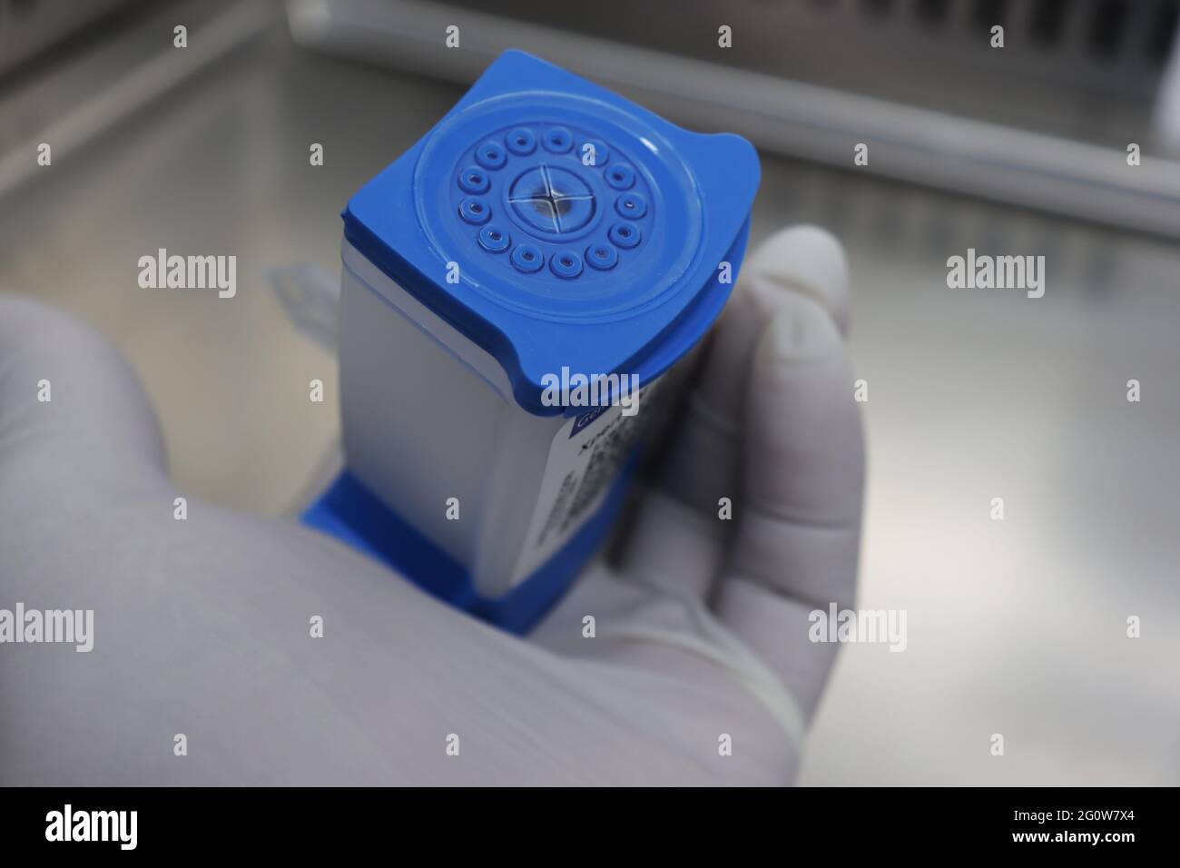 Gene-Xpert, ein CBNAAT-Test (Catridge-basierter Nukleinsäure-Amplifikationstest), ist ein weit verbreiteter diagnostischer Test für Tuberkulose. Dieser Test ist eine schnelle Diagnose Stockfoto