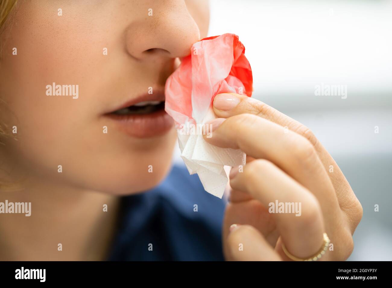 Frau zu stoppen Blut Blutungen aus Nase, die versuchen, Stockfoto