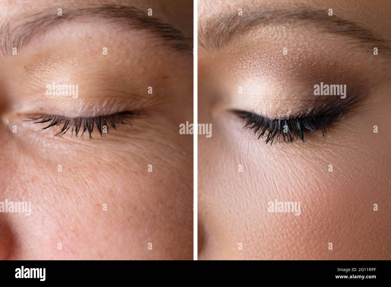Frau Gesicht Haut Make-Up. Vorher Und Nachher Vergleichen Stockfoto