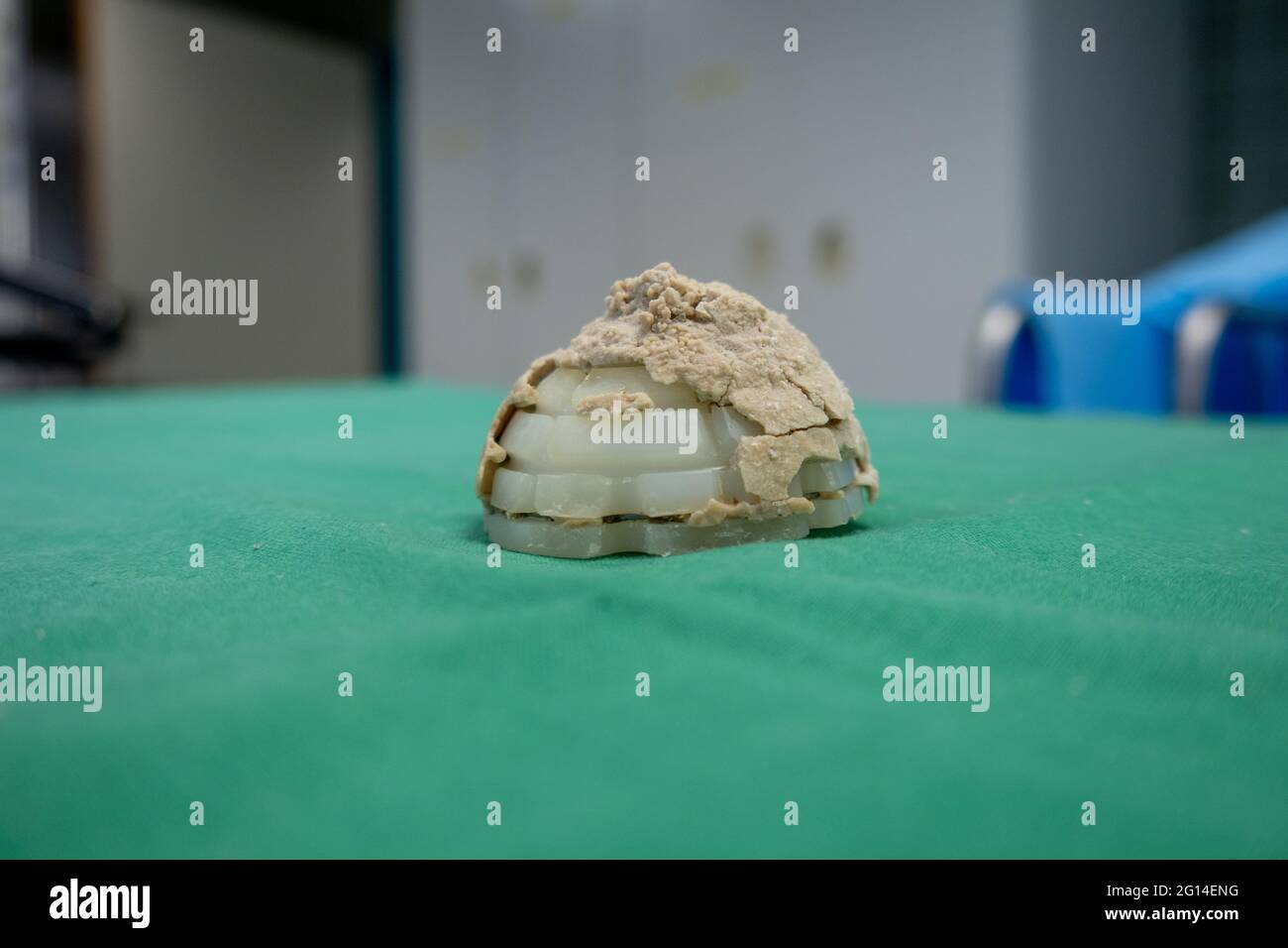 Eine explantierte Acetabulum liegt auf einem grünen OP-Tuch Stockfoto