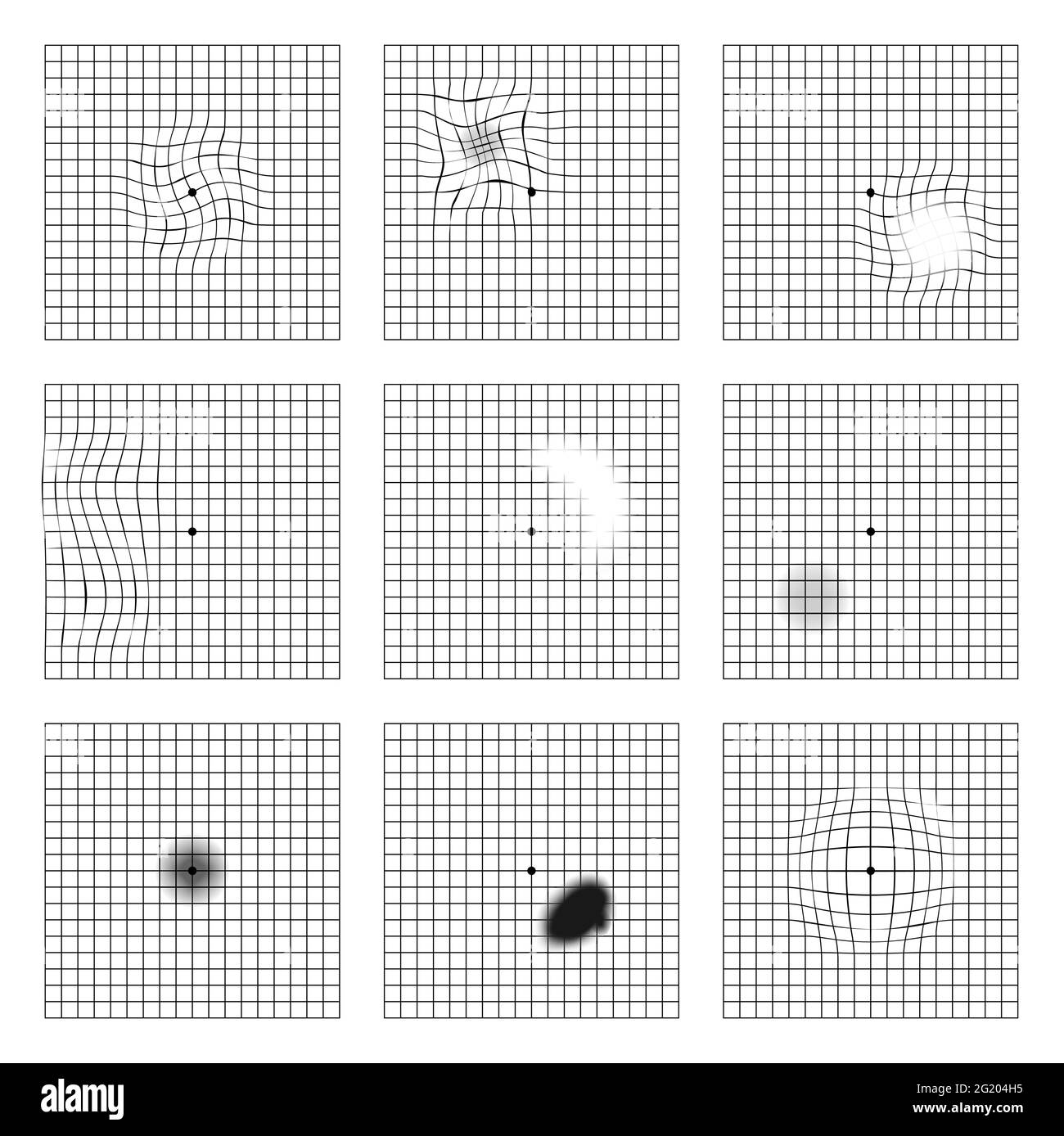 Amsler Augentestraster. Okulistische Vektor druckbare Karte Netzhaut Untersuchung. Raster mit Punkt in der Mitte. Sichtkontrolle. Stock Vektor