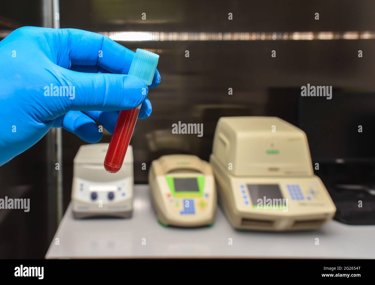 Die Untersuchung einer biologischen Probe im Labor. Labortests, biologische Analysen. Stockfoto