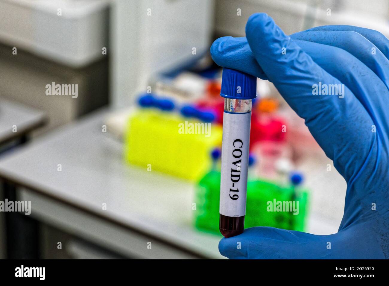 COVID-19-Forschung. Testen einer biologischen Probe auf Coronavirus. Stockfoto