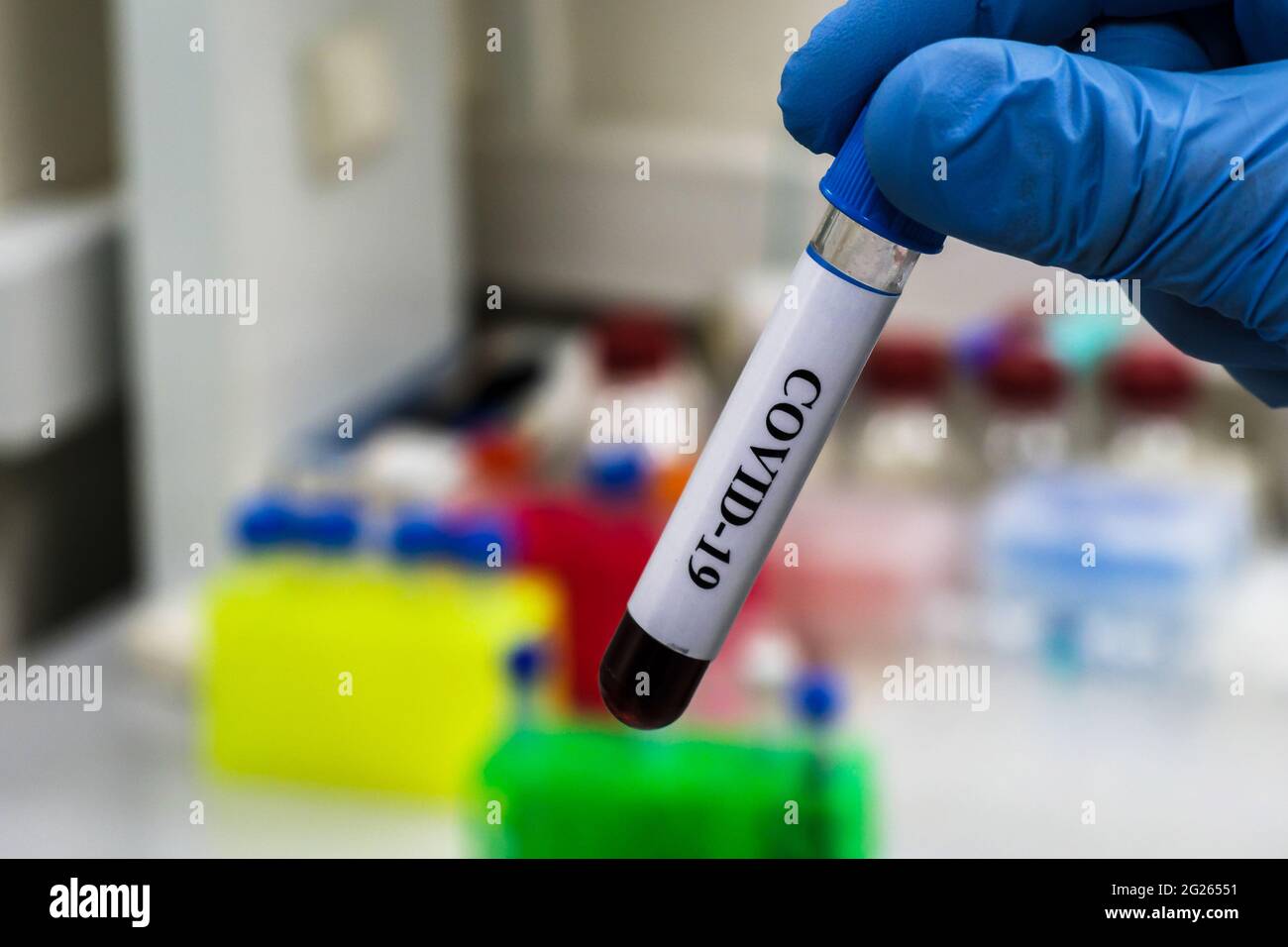 COVID-19-Forschung. Testen einer biologischen Probe auf Coronavirus. Stockfoto