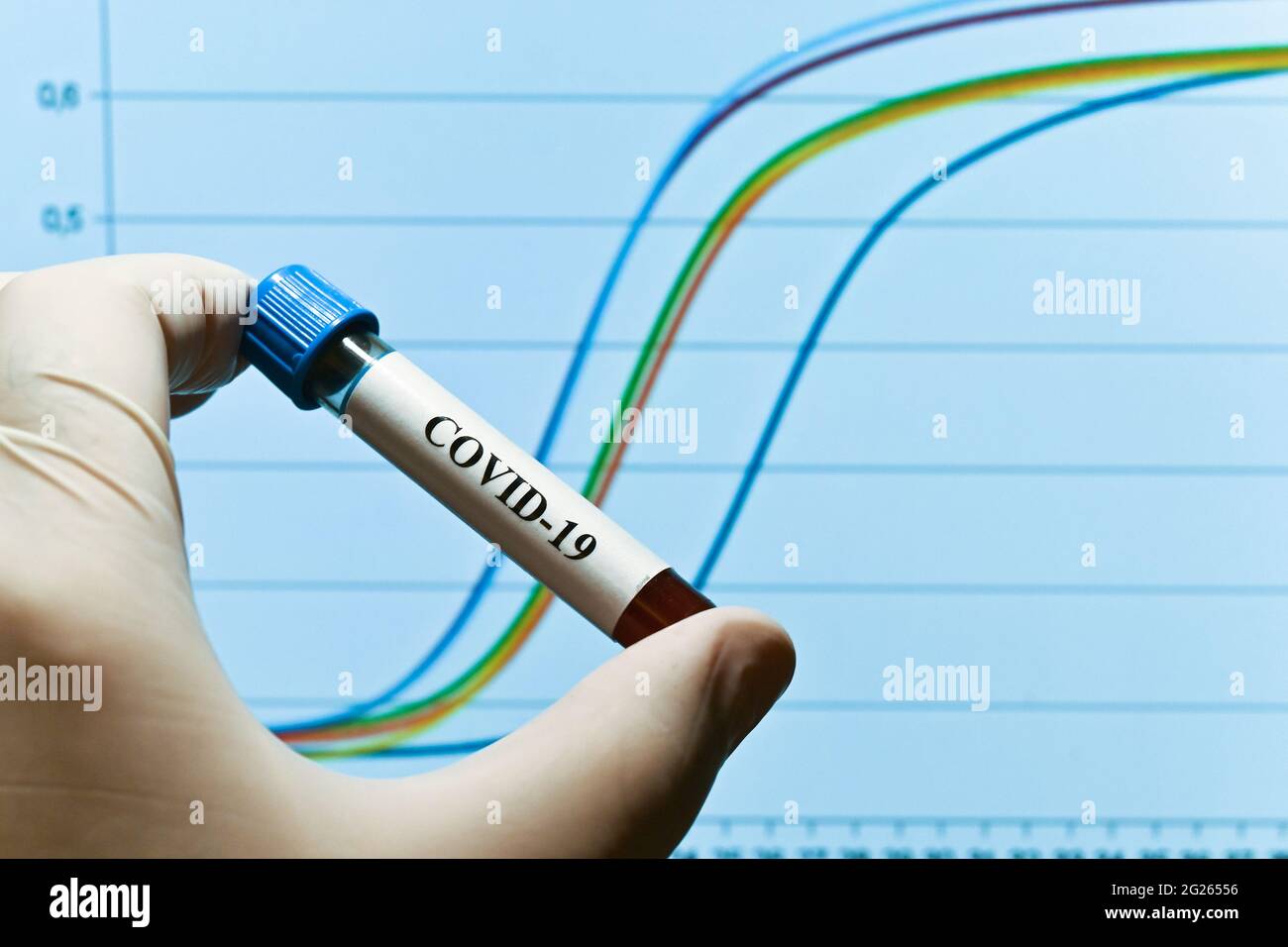 COVID-19-Forschung. Testen einer biologischen Probe auf Coronavirus. Stockfoto