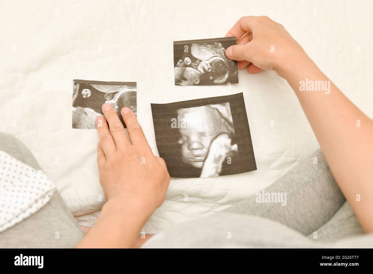Schwangere Frau mit 4D-Ultraschallbild. Erwartung eines Kindes Stockfoto