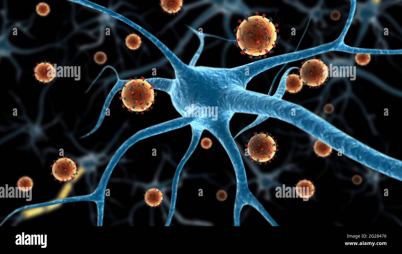 Biomedizinische Darstellung der östlichen Pferdenenzephalitis, die an eine Nervenzelle angehängt ist. Stockfoto