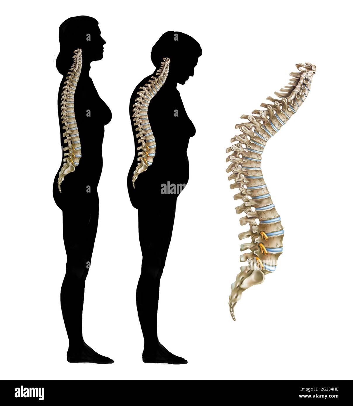 Normal anatomy of lumbar spine -Fotos und -Bildmaterial in hoher ...