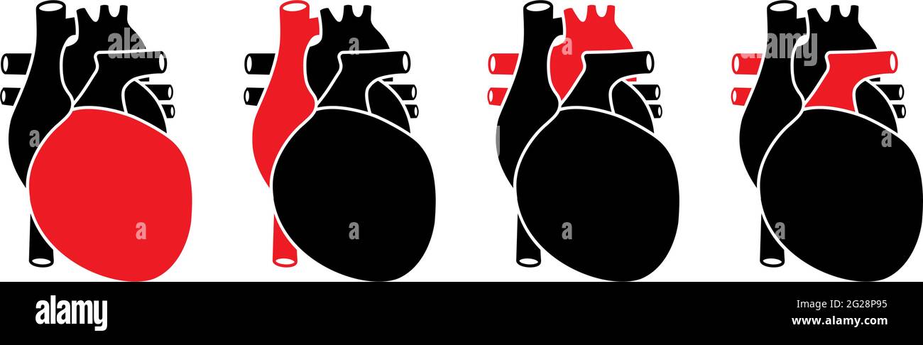 Menschliches Herz mit roten ausgewählten Teilen. Anatomisch korrekte Organdarstellung. Stock Vektor
