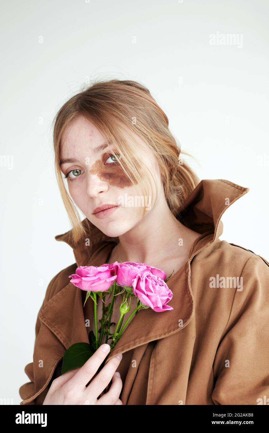 Nachdenkliche junge Frau in Jacke mit braunem Muttermal im Gesicht und rosa Blumen in der Hand, die in einem hellen Studio auf weißem Hintergrund auf die Kamera schaut Stockfoto