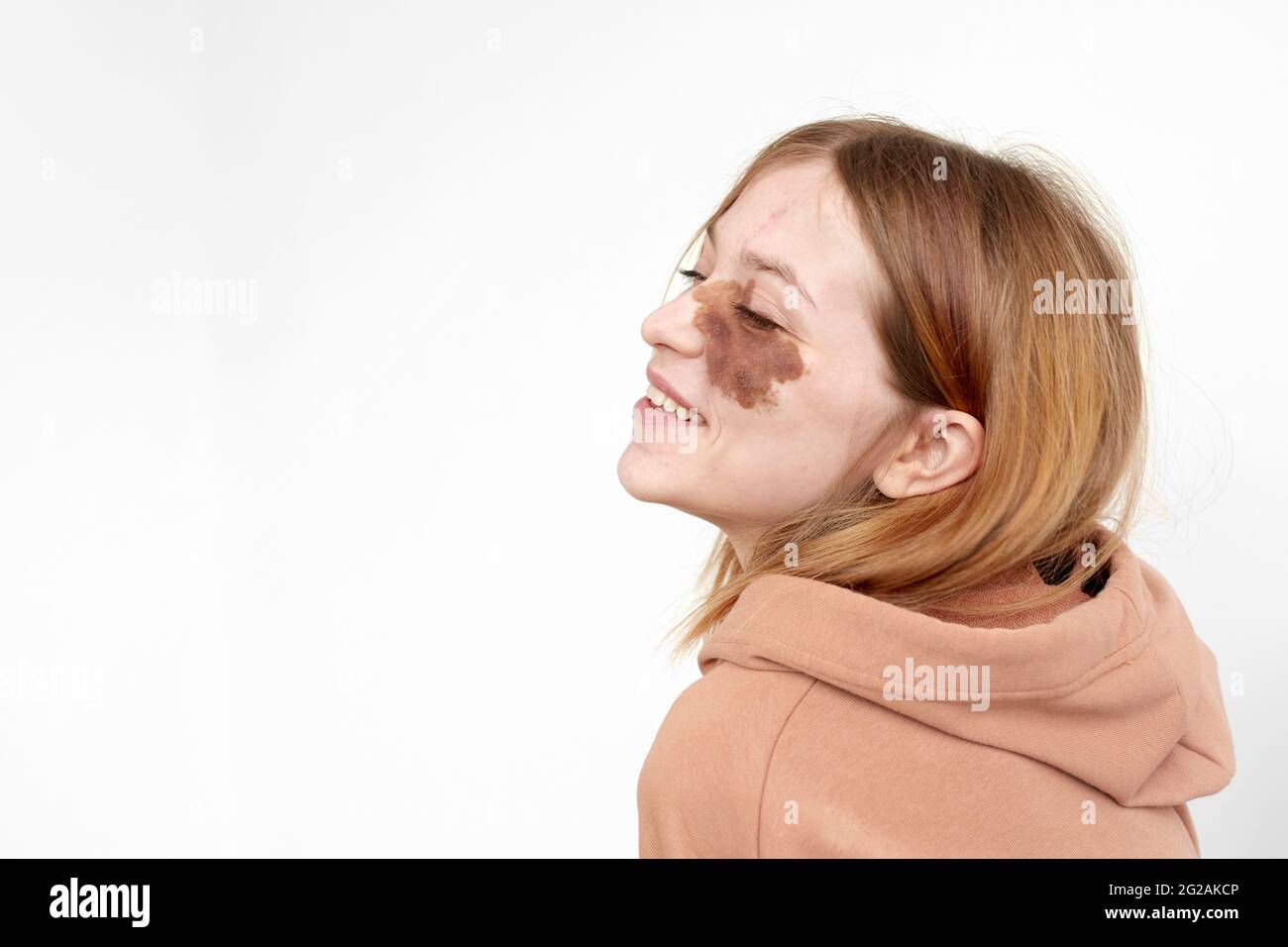 Seitenansicht einer glücklichen jungen Dame im Kapuzenpullover mit braunem Muttermal im Gesicht mit geschlossenen Augen auf weißem Hintergrund im hellen Studio Stockfoto
