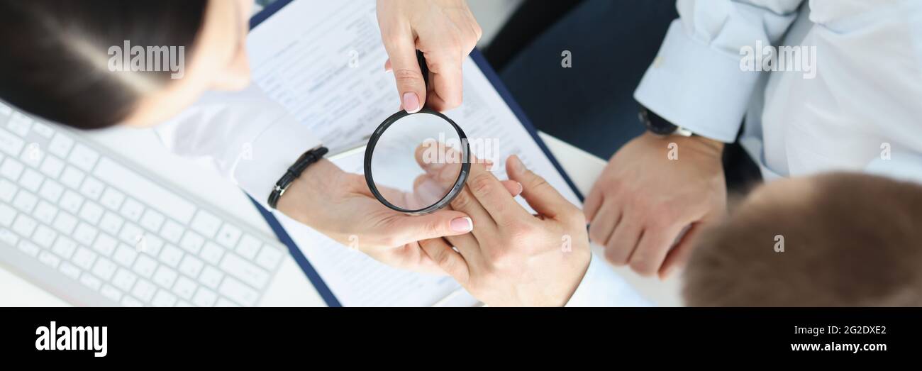 Dermatologe betrachtet Patienten Haut auf Händen mit Lupe Draufsicht Stockfoto