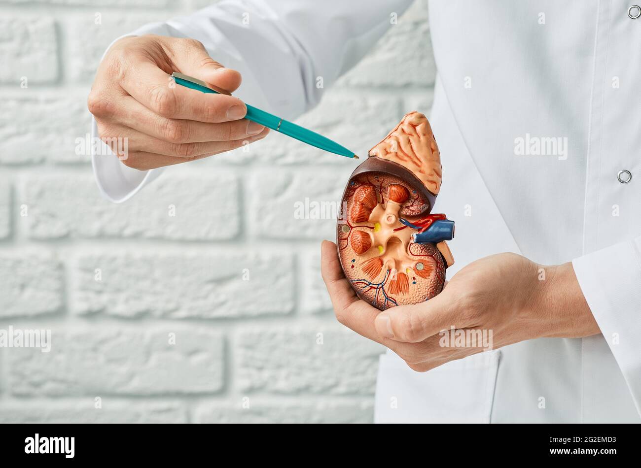 Konzept zur Nierengesundheit. Nahaufnahme, anatomisches Modell der menschlichen Niere in den Händen des Arztes. Urologie Stockfoto