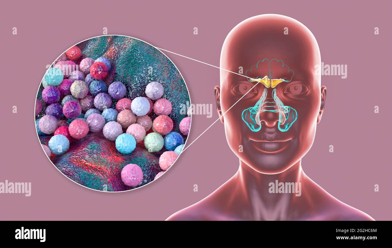 Maxillary sinus Fotos und Bildmaterial in hoher Auflösung Alamy