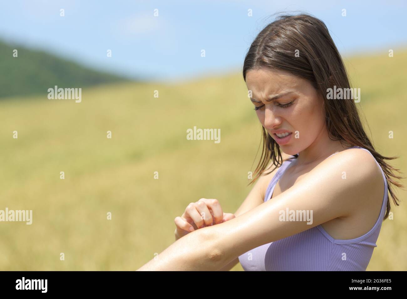 Allergische Frau kratzt juckenden Arm in einem Weizenfeld im Sommer Stockfoto