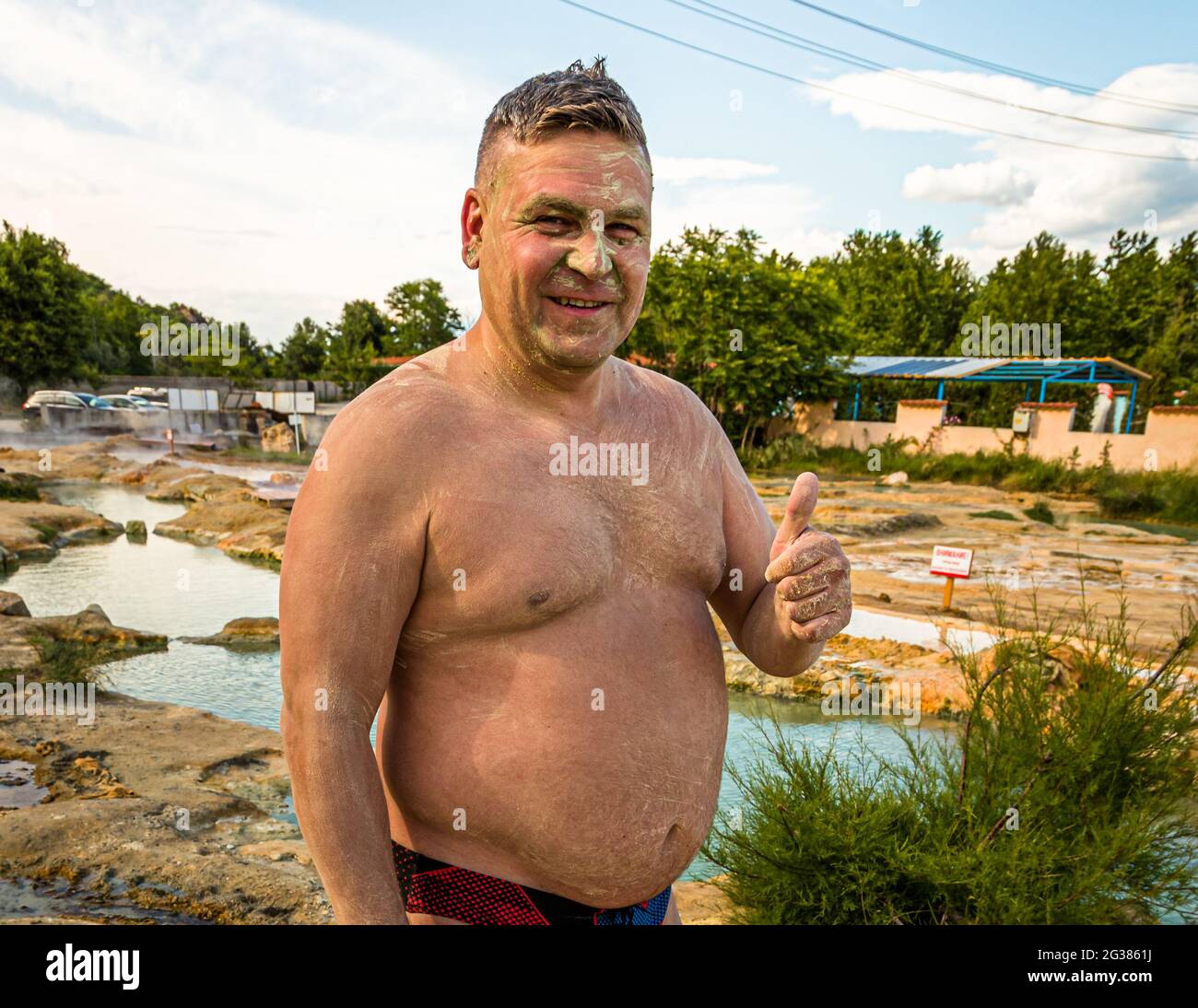 Nach dem Thermalbad mit schwefelhaltigem Schlamm beschmiert. Mineralbäder Rupite bei Petrich, Bulgarien Stockfoto