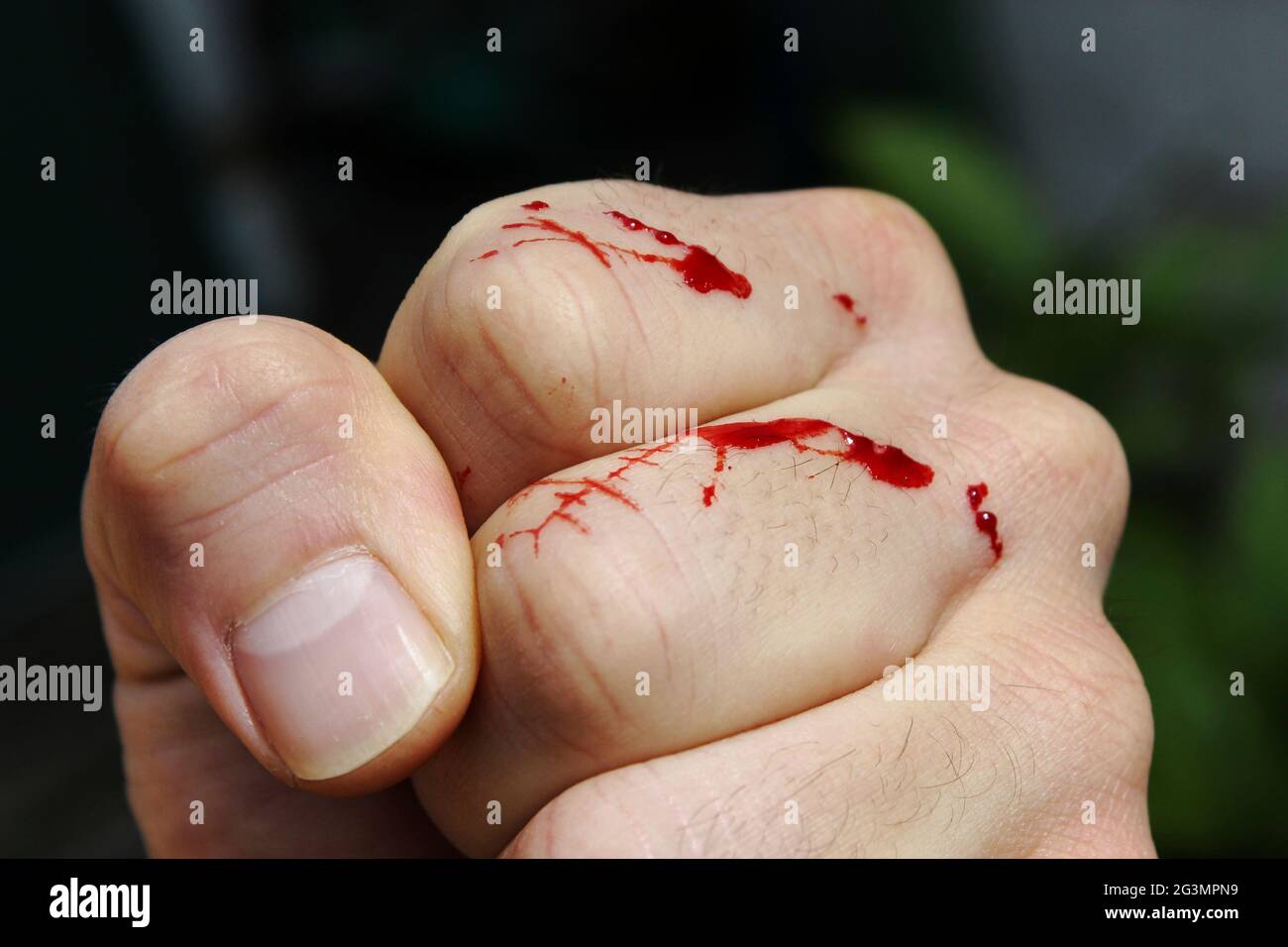 Die Hand des Mannes wurde von einer Katze im Garten frisch zerkratzt. Frisches Blut kommt aus der Hautschicht. Spritzer von Bluttropfen auf einer weißen Blume Stockfoto