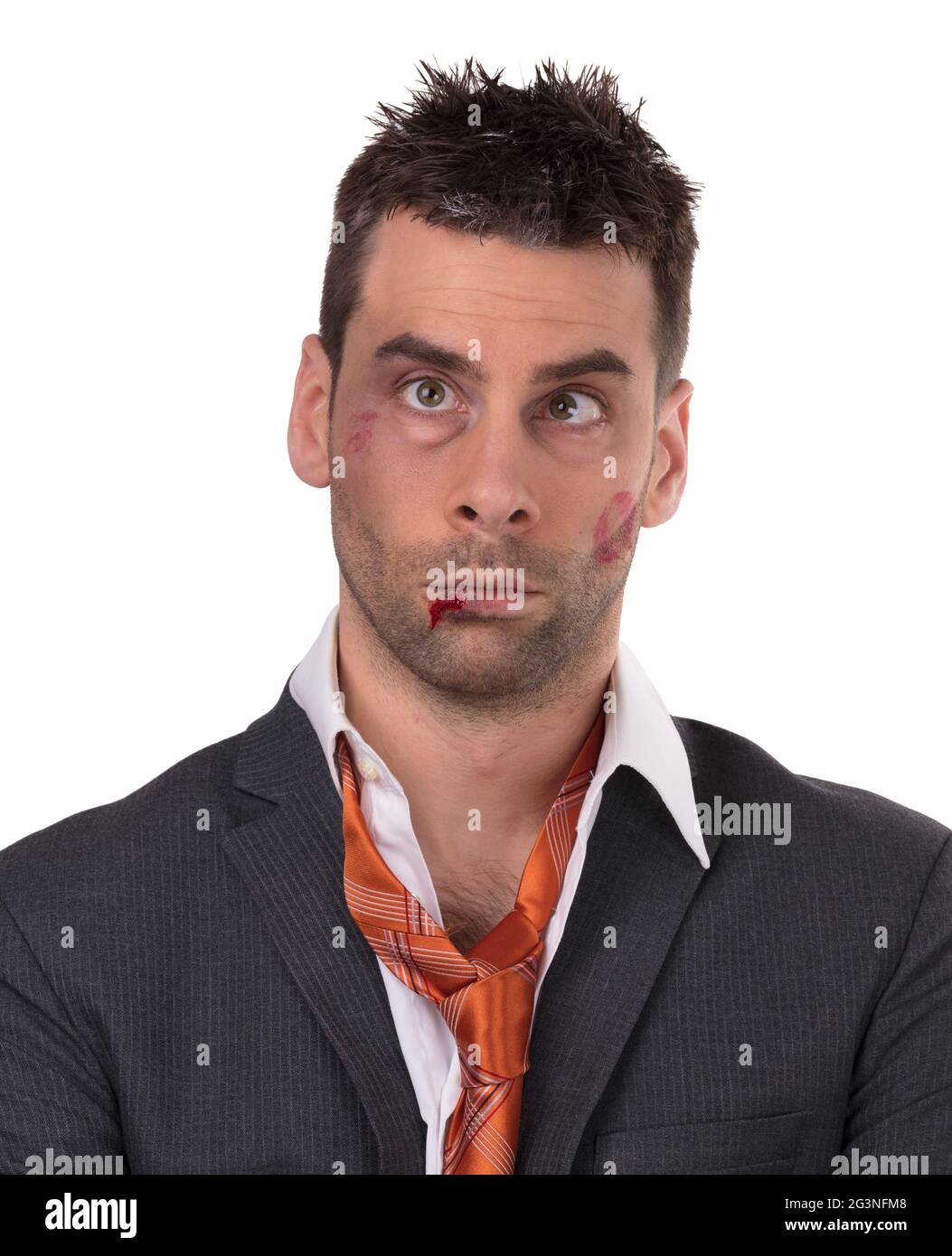 Nahaufnahme eines Geschäftsmannes mit blutiger Lippe, geschlagen und gequetscht Stockfoto