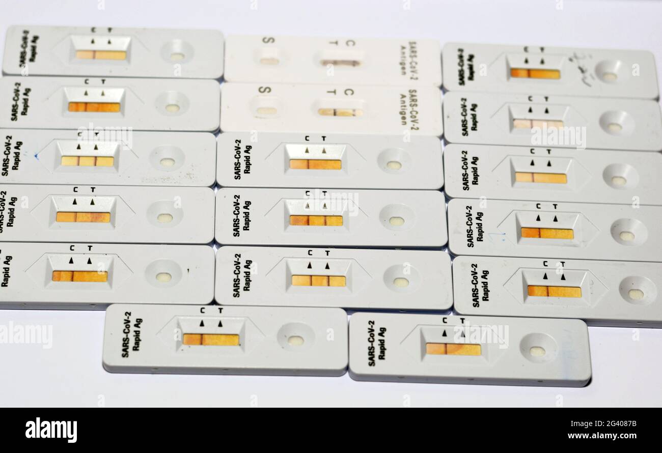 Erfassung positiver und negativer Ergebnisse des SARS-CoV-2 Rapid Antigen AG-Tests mit ...