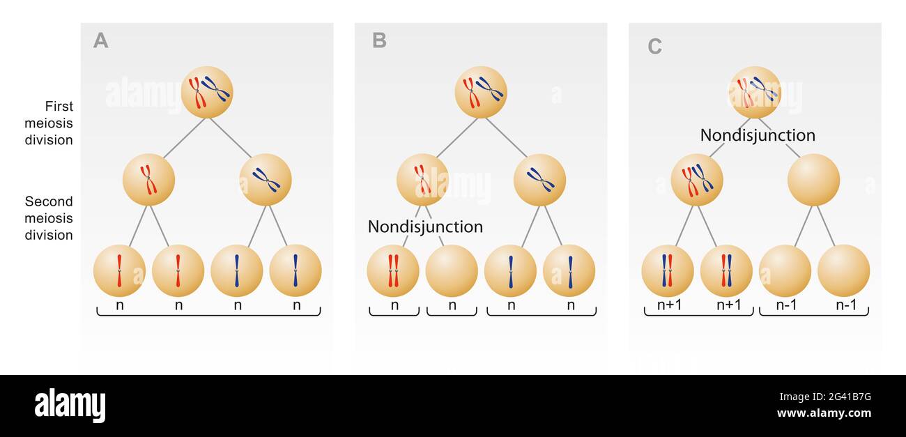 Meiotische Nondisjunktion. Das Versagen eines oder mehrerer Paare von homologen Chromosomen, sich während der nuklearen Teilung normal zu trennen Stockfoto