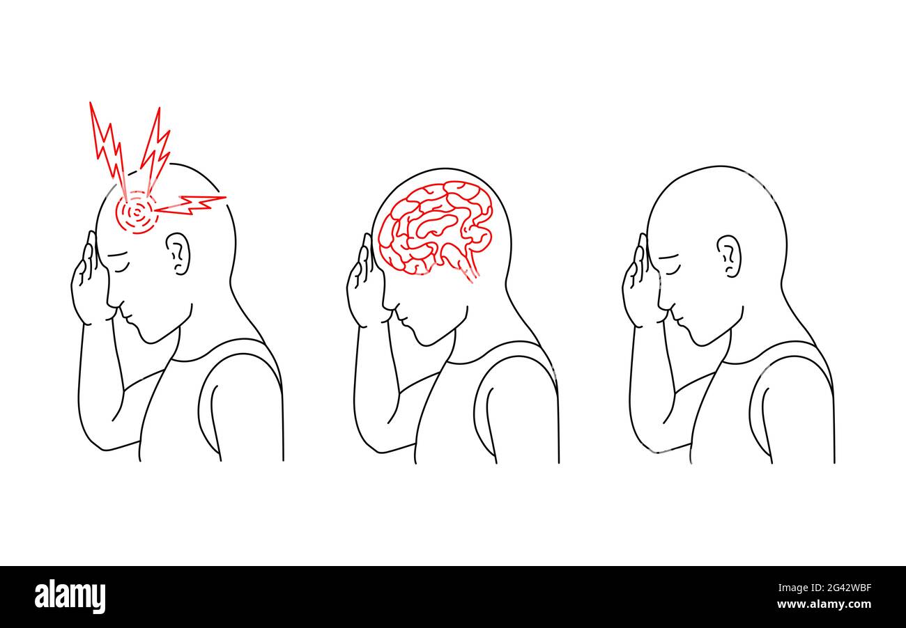 Vektordarstellung einer Person, die Kopfschmerzen und Entzündungen des menschlichen Gehirns hat. Stockfoto