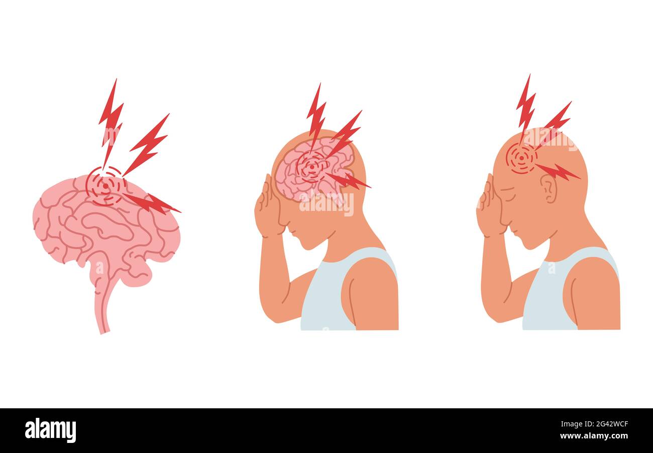 Vektordarstellung einer Person, die Kopfschmerzen und Entzündungen des menschlichen Gehirns hat. Stockfoto