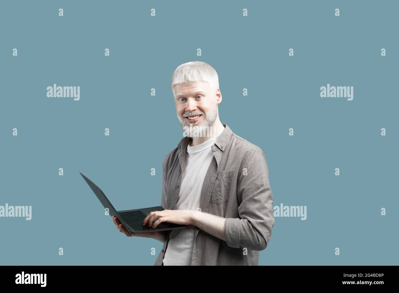 Moderne Technologien. Glücklich Albino Kerl mit Laptop-Computer über türkisfarbenen Hintergrund, genießen Remote-Job-Angebote Stockfoto