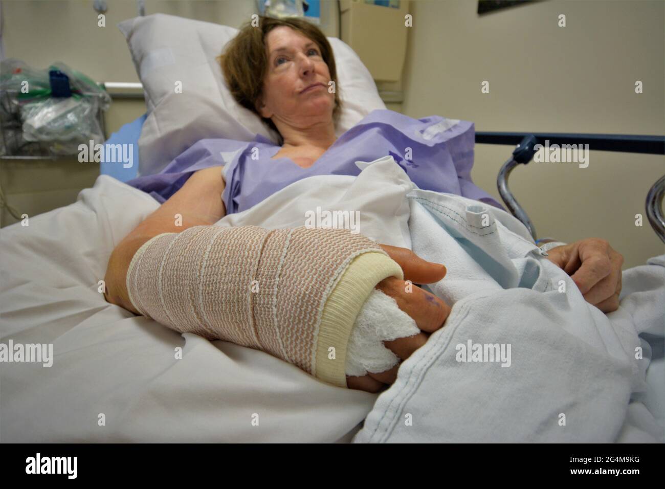 Ältere Frau im Krankenhaus Notaufnahme Bett nach einem nächtlichen Sturz, die sie brach sind und Handgelenk auf ihrem rechten Arm, die sie dominieren für die Arbeit verwendbar ist Stockfoto