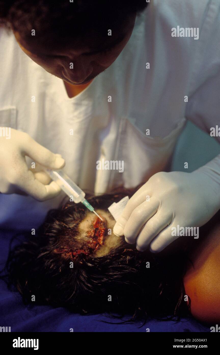 Patient im Krankenhaus, Arzt kümmert sich um eine Wunde auf dem Kopf. Stockfoto
