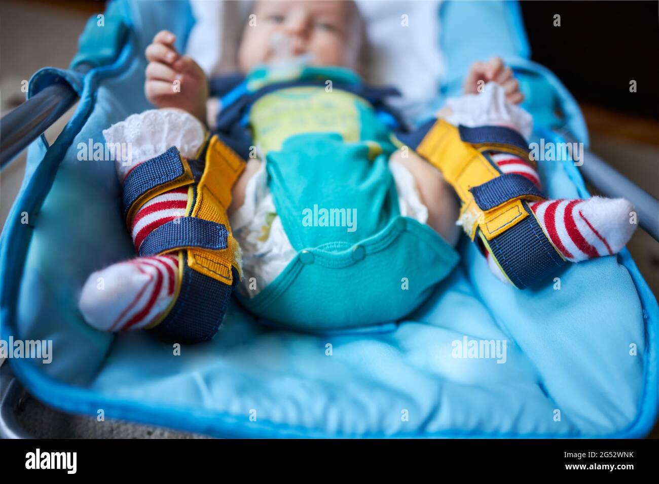 Ein Baby mit einem Geschirr, das Hüftdysplasie korrigiert Stockfoto