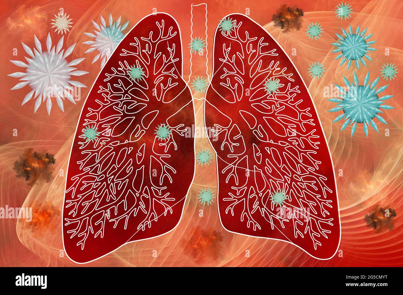 Schädigung des menschlichen Lungenorgans durch das 3D-Covid19-Virus. Fraktales Modell, Abstraktion Stockfoto