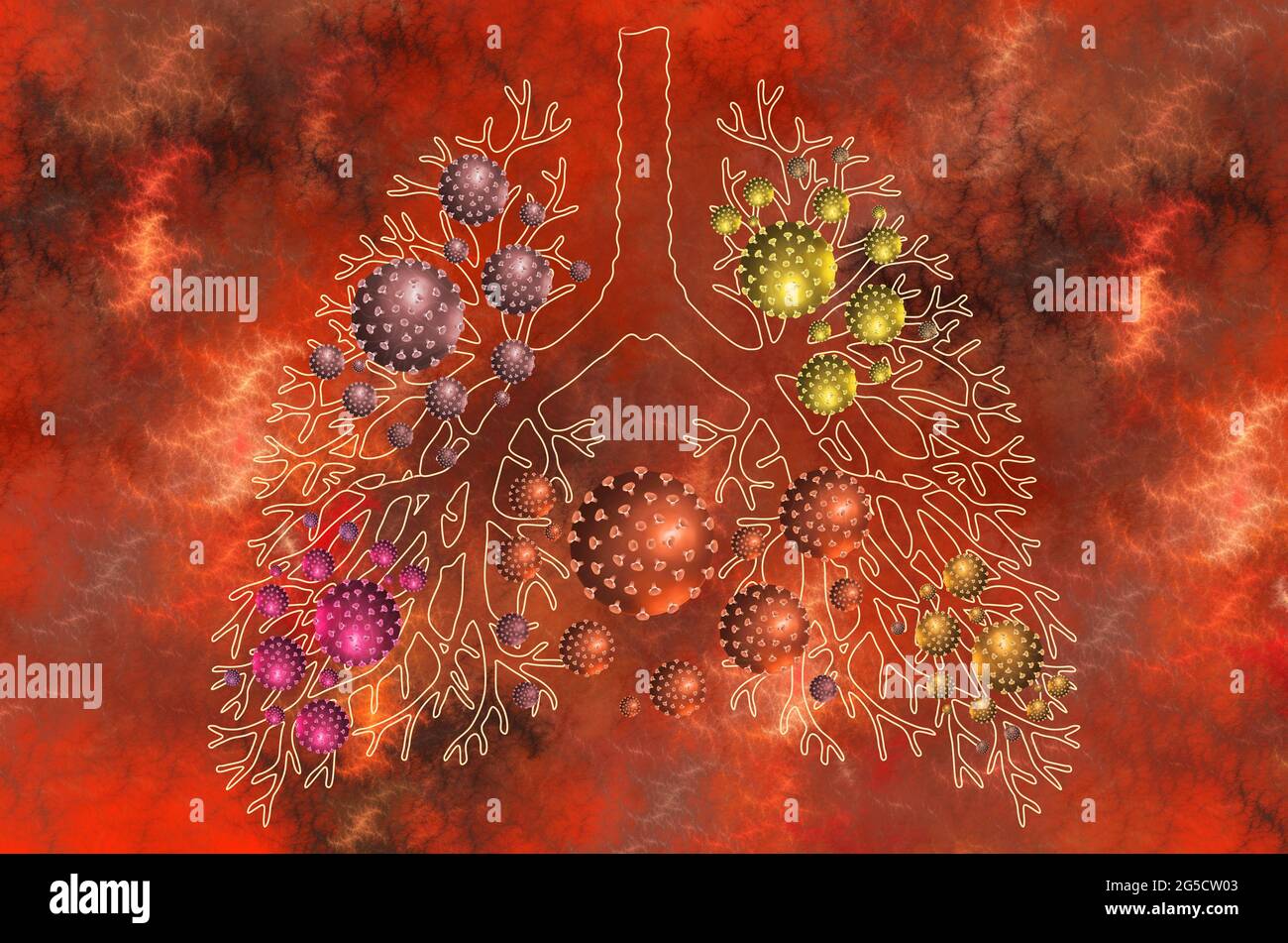 Schädigung des menschlichen Lungenorgans durch verschiedene Mutationen des Covid19-Virus. Fraktales 3D-Modell des Coronavirus, Abstraktion Stockfoto