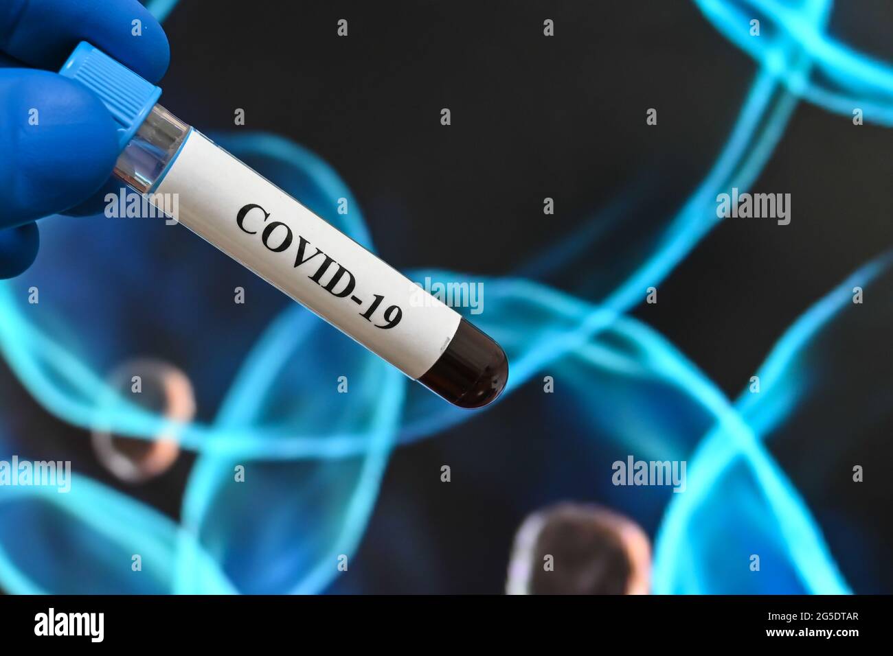 Coronavirus-Forschung. Laborstudie des Virus - der Erreger von COVID-19. Stockfoto