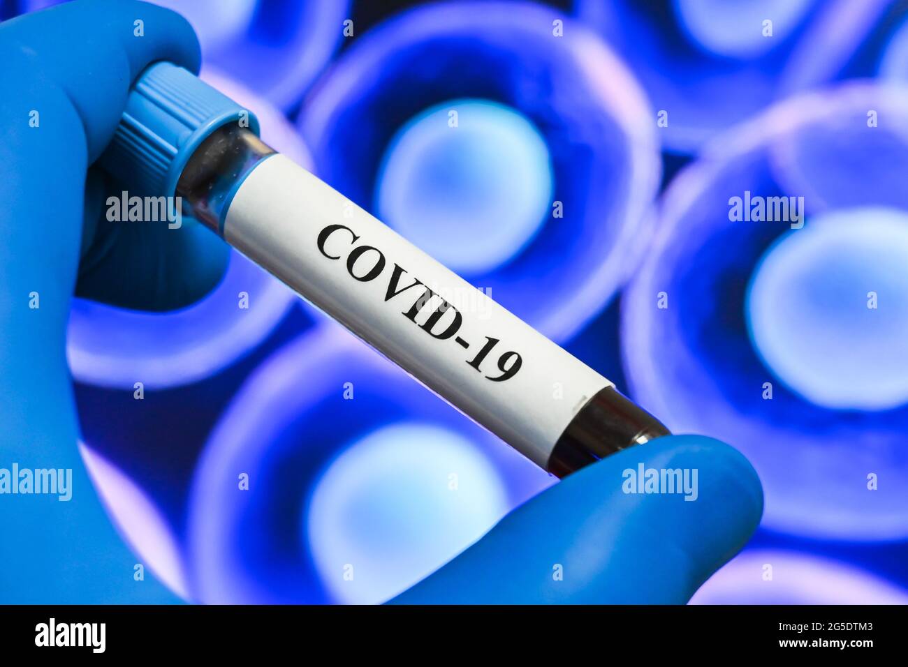Coronavirus-Forschung. Laborstudie des Virus - der Erreger von COVID-19. Stockfoto