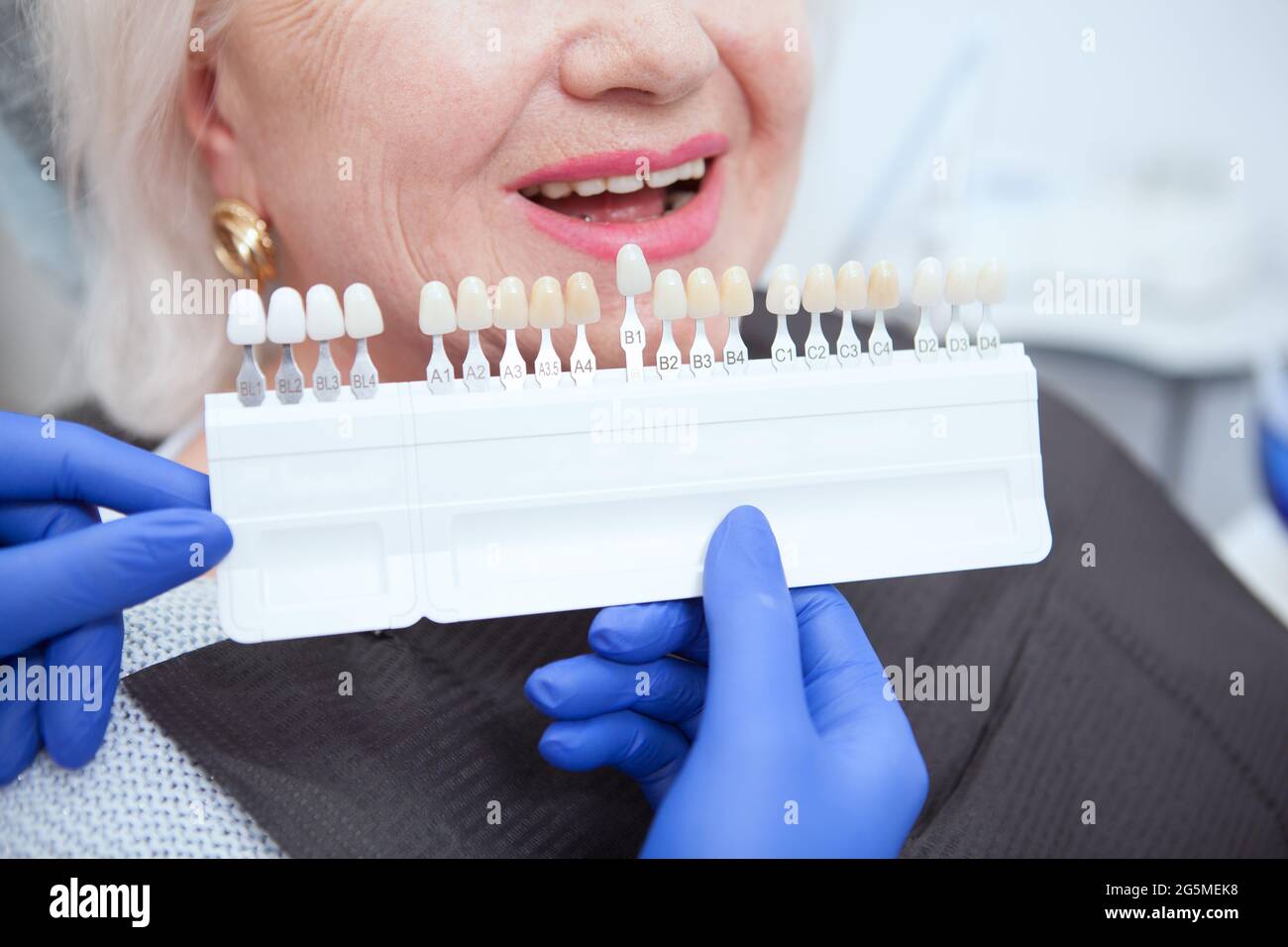 Zahnarzt, der die Zahnaufhellung in der Nähe der Zähne einer älteren Patientin hält Stockfoto