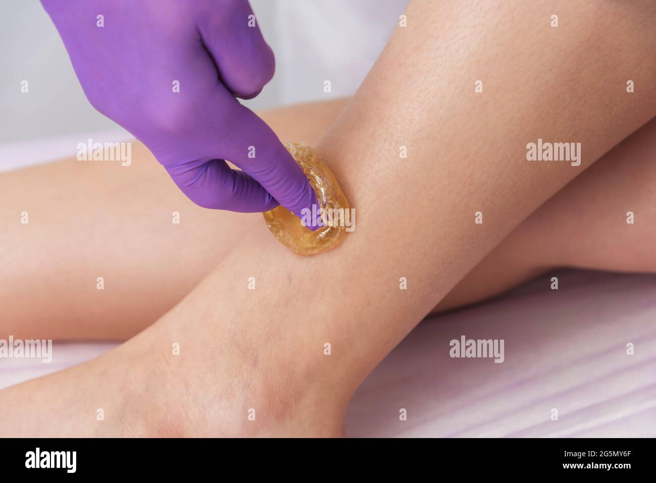Trockenzuckerung epilation Skin Care mit flüssigem Zucker auf die Beine. Stockfoto