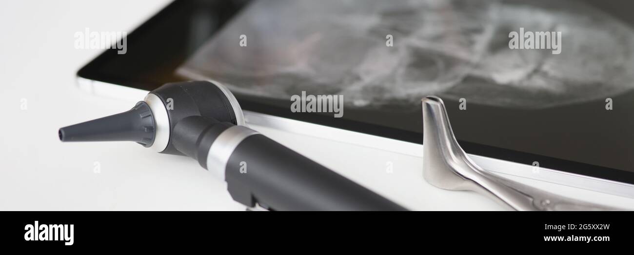 Ein Otoskop mit Röntgenaufnahme ist auf dem Tisch Stockfoto