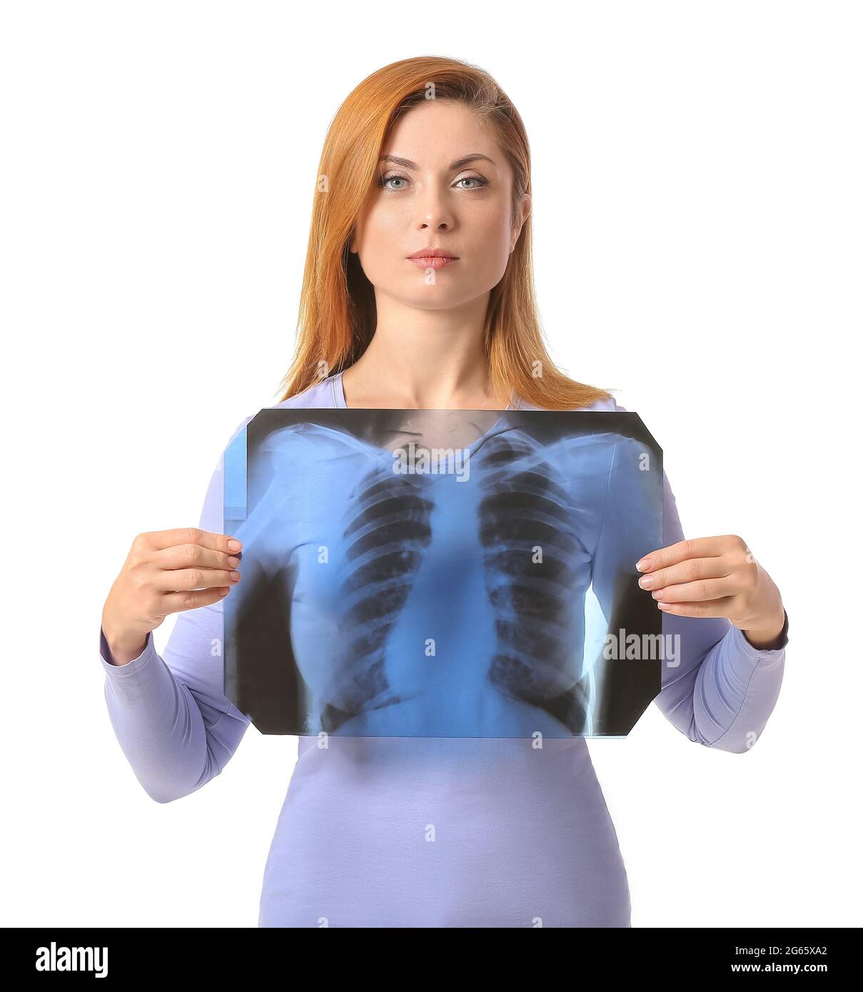 Frau mit Röntgenbild der Lunge auf weißem Hintergrund Stockfoto