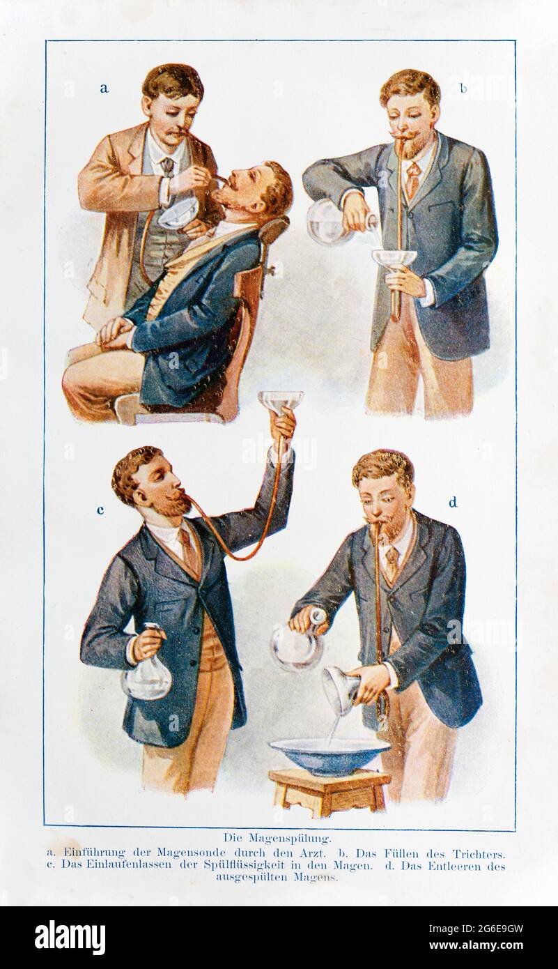 Magenspülung, der praktische Hausarzt, EIN Weg zur Gesundheit, 1901, Breslau Stockfoto