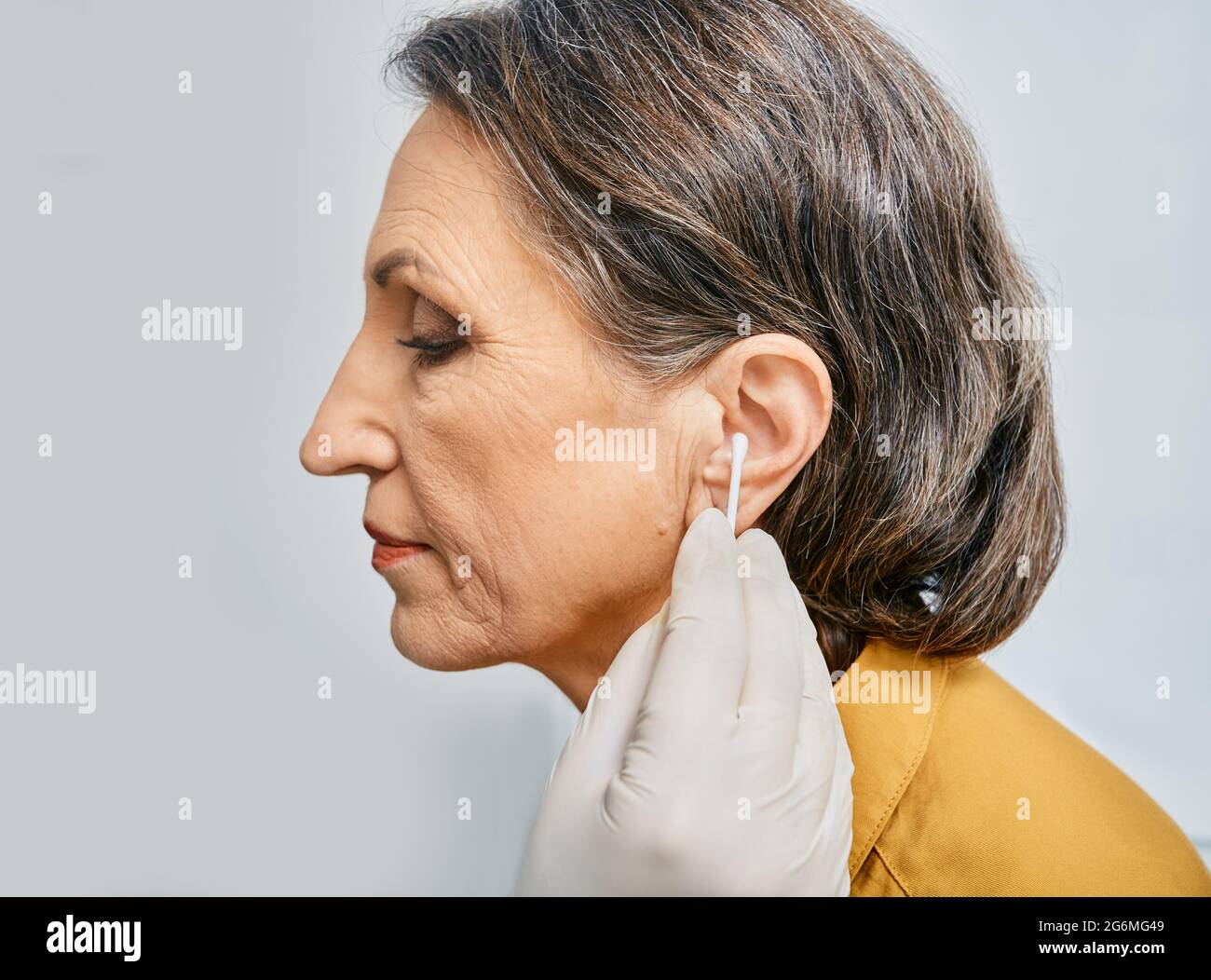 HNO-Arzt reinigt das Ohr des Patienten mit Wattestäbchen, entfernen Sie Ohrenwachs in der medizinischen Klinik, Seitenansicht Stockfoto
