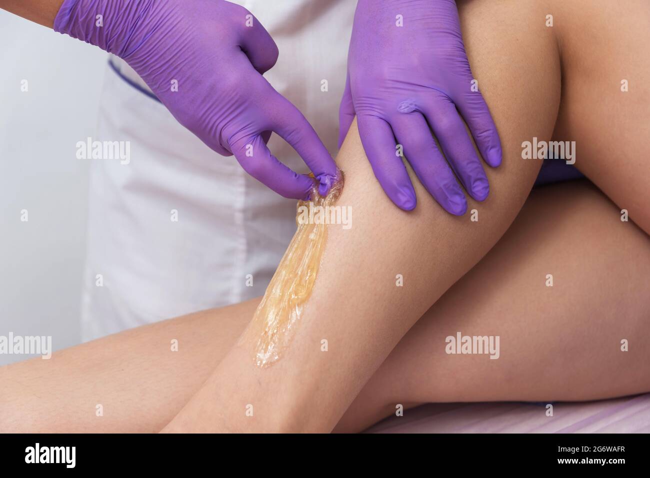 Trockenzuckerung epilation Skin Care mit flüssigem Zucker auf die Beine. Stockfoto