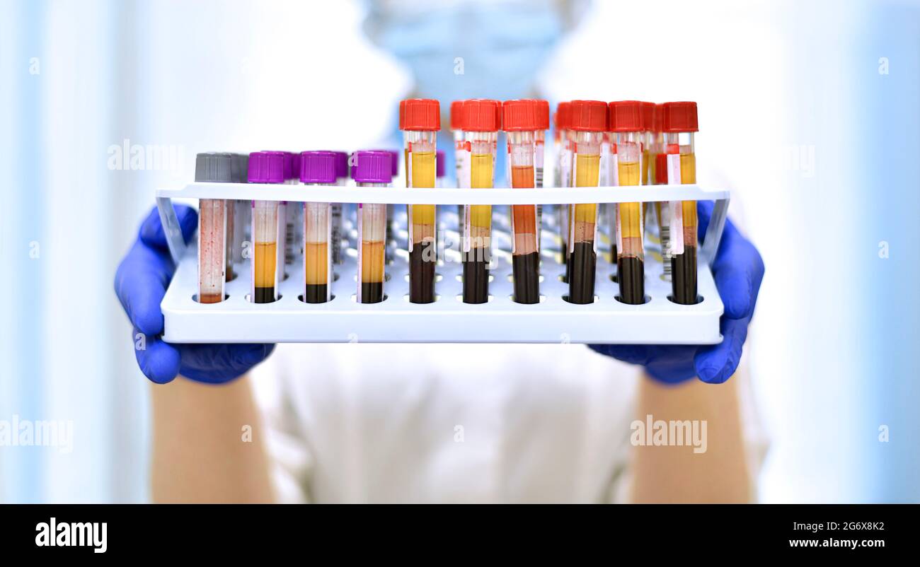 Ein Labormediziner zeigt einen Stand mit Reagenzgläsern, die mit venösem Blut gefüllt sind, zur Analyse. Stockfoto